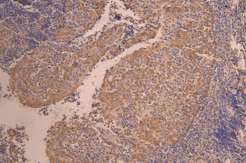 IL6 Antibody