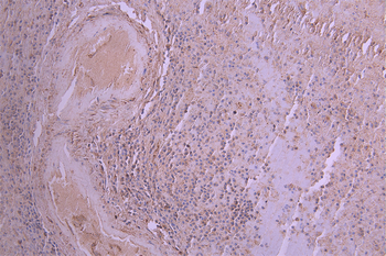 IL6 Antibody