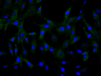 IL6 Antibody