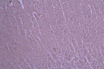 IL23R Antibody