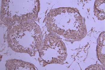 IL23R Antibody