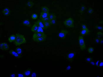 IL23R Antibody