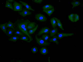 POSTN Antibody