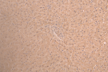 ANG Antibody