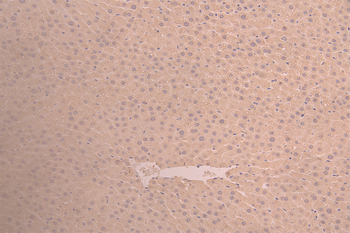 ANG Antibody
