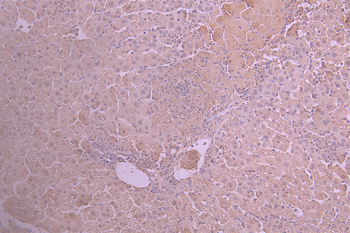 ANG Antibody