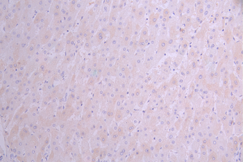 TTN Antibody