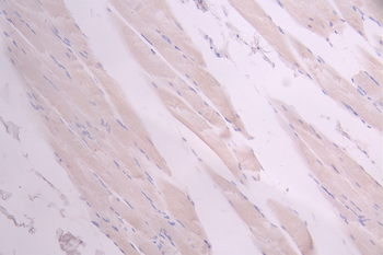 TTN Antibody
