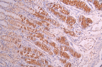 PTH Antibody