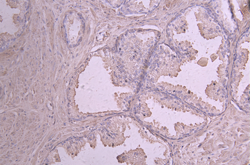 IL12A Antibody