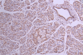ENO1 Antibody