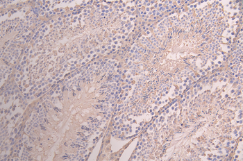 AGBL2 Antibody