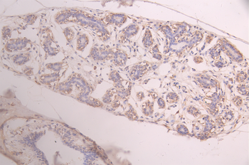 AGBL2 Antibody