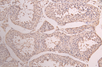 HSPA8 Recombinant Monoclonal Antibody