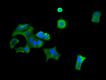 HSPA8 Recombinant Monoclonal Antibody