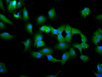 TSG101 Antibody