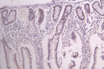 FILIP1L Antibody