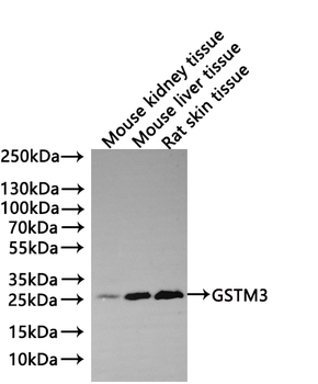 GSTM3 Antibody