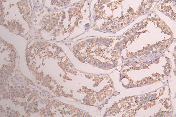 GSTM3 Antibody