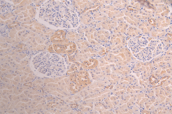 GSTM3 Antibody