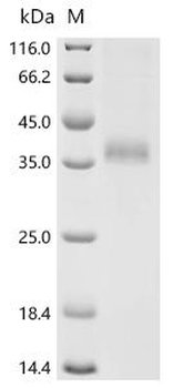 Recombinant Human E3 ubiquitin-protein ligase MIB1 (MIB1), partial