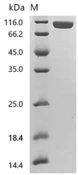 Recombinant Human Dipeptidyl peptidase 4 (DPP4), partial