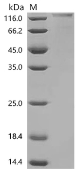 Recombinant Human Glycylpeptide N-tetradecanoyltransferase 1 (NMT1)