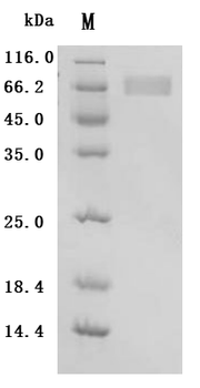 Recombinant Human Fibroblast growth factor receptor 3 (FGFR3), partial (Active)