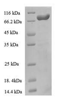 Recombinant Escherichia coli Anaerobic ribonucleoside-triphosphate reductase (nrdD)