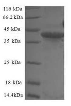 Recombinant Human Small nuclear ribonucleoprotein Sm D2 (SNRPD2)