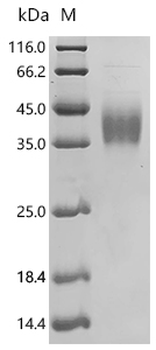 Recombinant Human SLAM family member 7 (SLAMF7), partial (Active)
