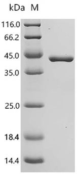 Recombinant Human Chitinase-3-like protein 1 (CHI3L1) (Active)