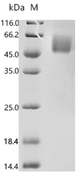 Recombinant Human Interleukin-1 receptor-like 2 (IL1RL2), partial (Active)