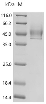 Recombinant Human Syndecan-1 (SDC1), partial (Active)