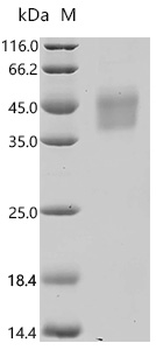 Recombinant Human Interleukin-21 receptor (IL21R), partial (Active)