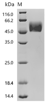 Recombinant Human Signal-regulatory protein beta-1 (SIRPB1), partial (Active)