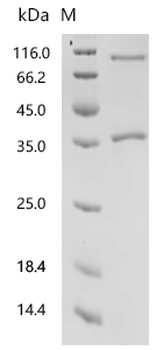 Recombinant Human Neurogenic locus notch homolog protein 1 (NOTCH1), partial