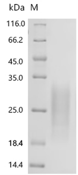 Recombinant Human Transmembrane and immunoglobulin domain-containing protein 2 (TMIGD2), partial