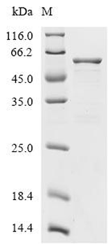 Recombinant Human Peripherin (PRPH)