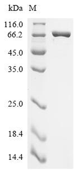Recombinant Escherichia coli Aspartate--tRNA ligase (aspS)