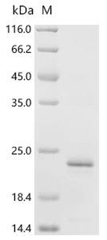 Recombinant Human Activating signal cointegrator 1 complex subunit 3 (ASCC3)