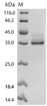Recombinant Human Tumor necrosis factor receptor superfamily member 12A (TNFRSF12A), partial