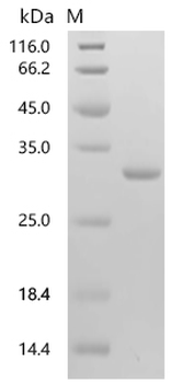 Recombinant Human HLA class II histocompatibility antigen, DM beta chain (HLA-DMB),partial