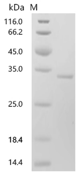 Recombinant Human HLA class II histocompatibility antigen, DP beta 1 chain (HLA-DPB1), partial