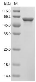 Recombinant Human Peripherin (PRPH)