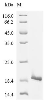 Recombinant Human Transcription factor E2-alpha (TCF3), partial