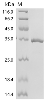 Recombinant Human Transcription factor E2-alpha (TCF3), partial