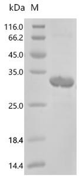 Recombinant Human N(4)-(beta-N-acetylglucosaminyl)-L-asparaginase (AGA), partial