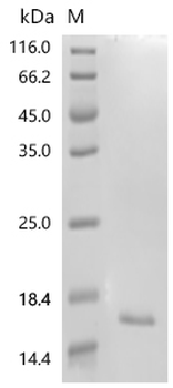 Recombinant Human Protein GPR15LG (GPR15LG)