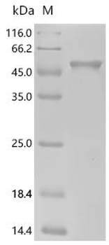 Recombinant Human Alpha-1-antichymotrypsin (SERPINA3)